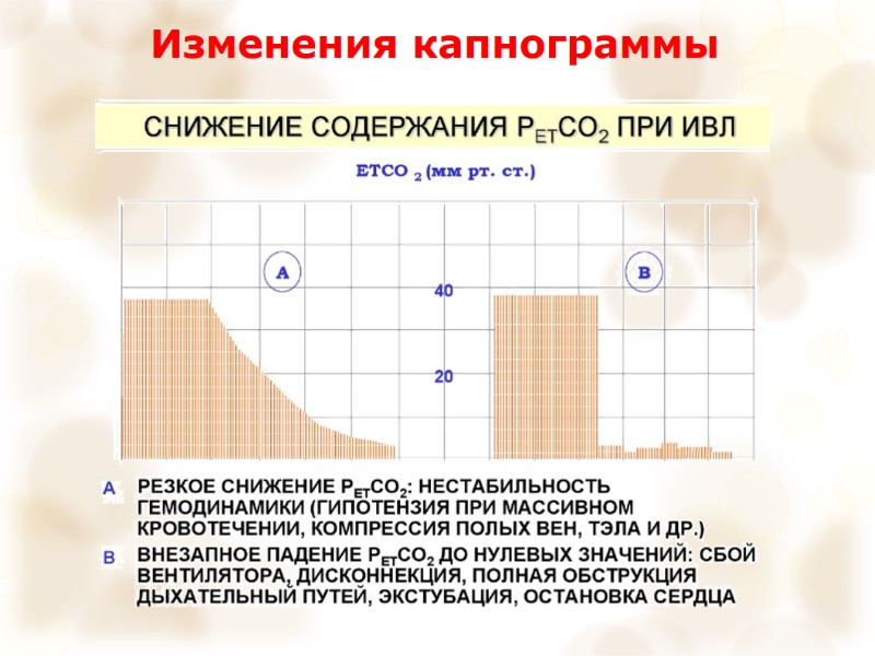 Изменения капнограммы